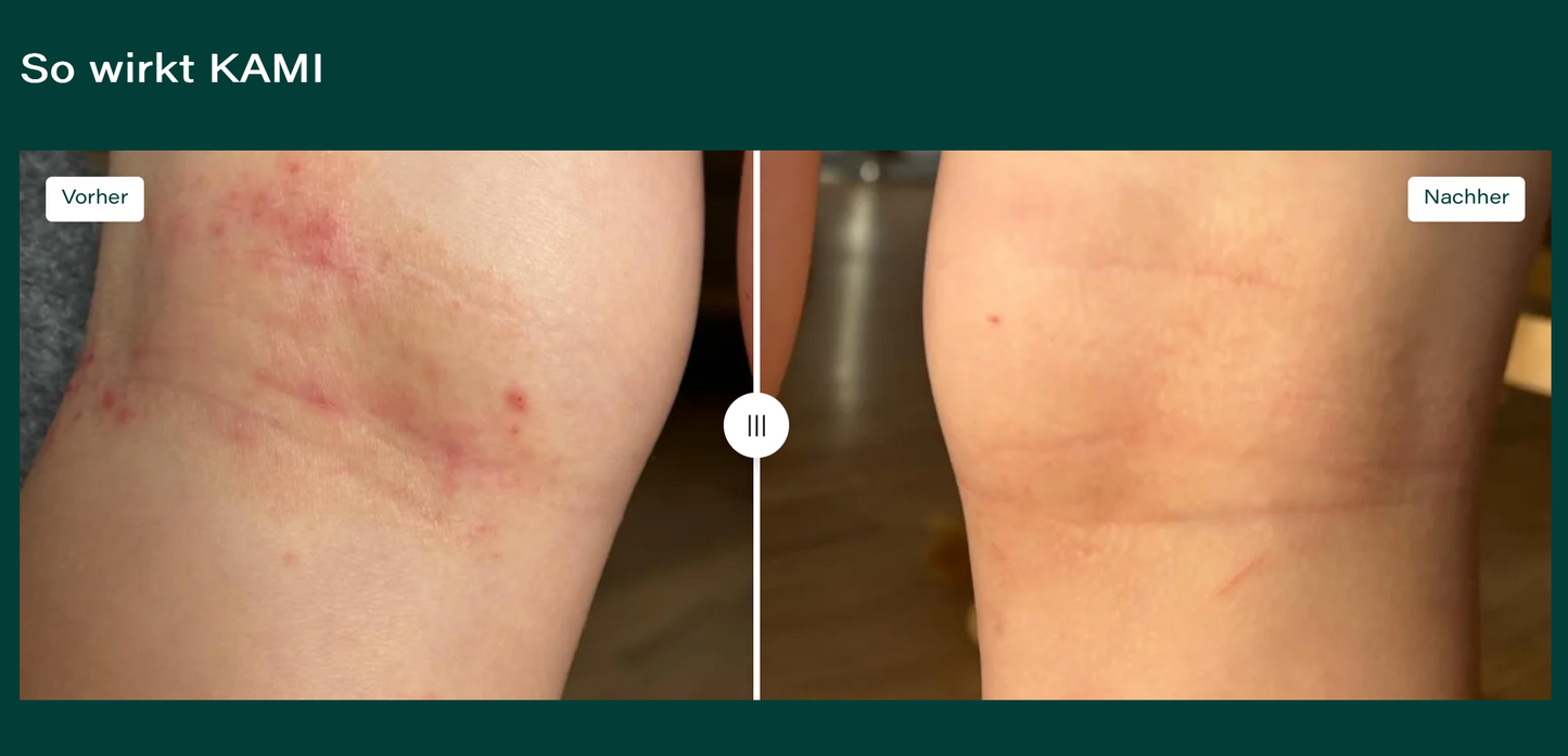 KAMI SOS Hautpflegeöl Roll-on